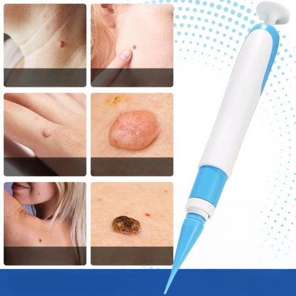 NordDerm™ - Smärtfri behandling på en vecka