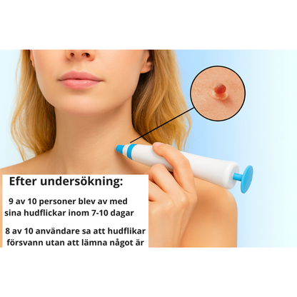 NordDerm™ - Smärtfri behandling på en vecka